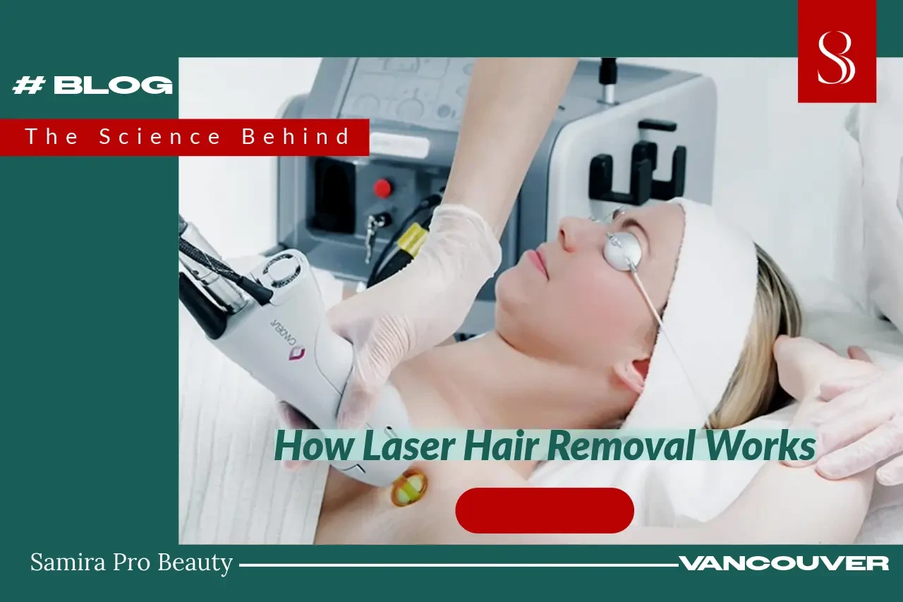 how laser works