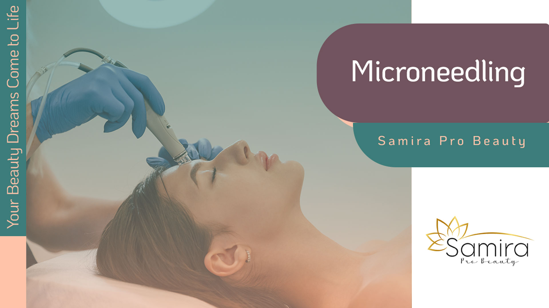Revitalize Your Skin with Micro-needling Vancouver