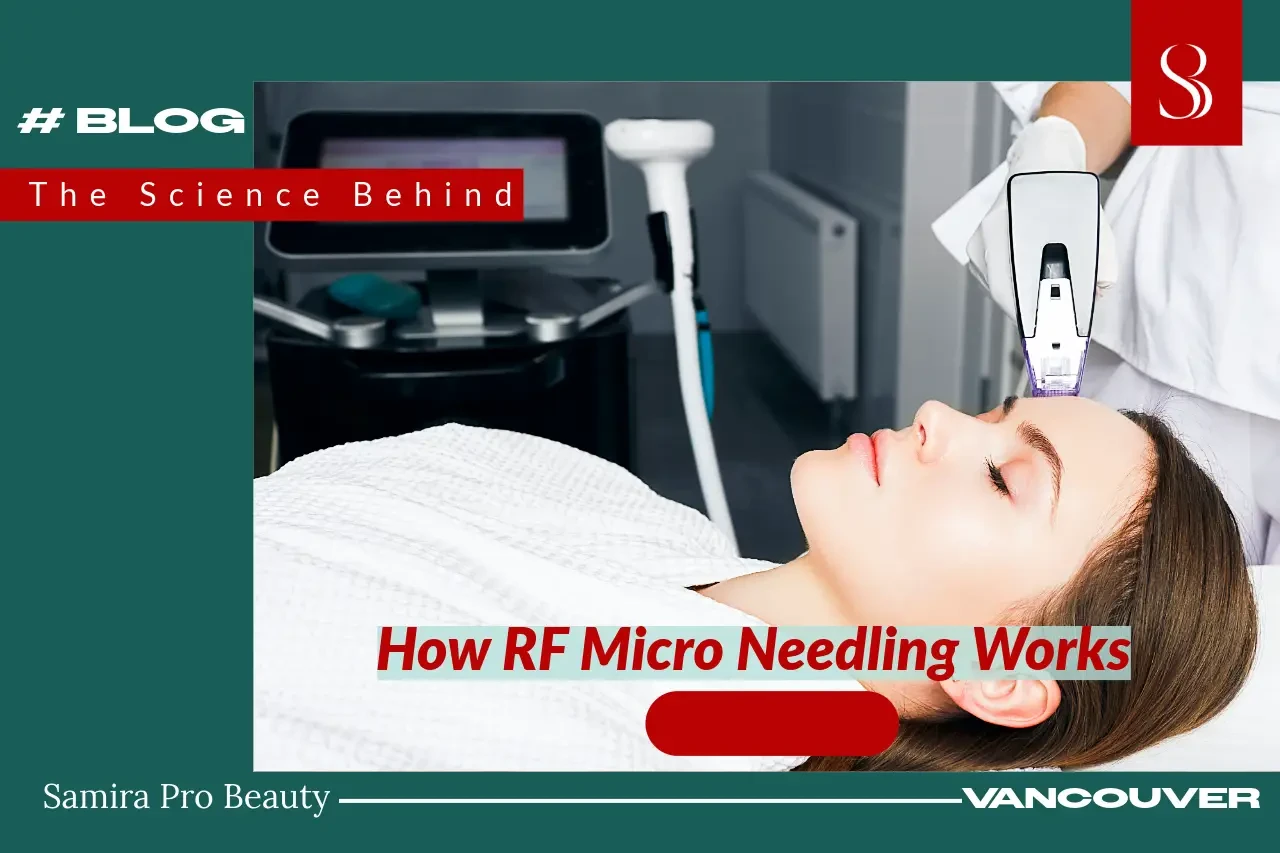 how rf microneedling works