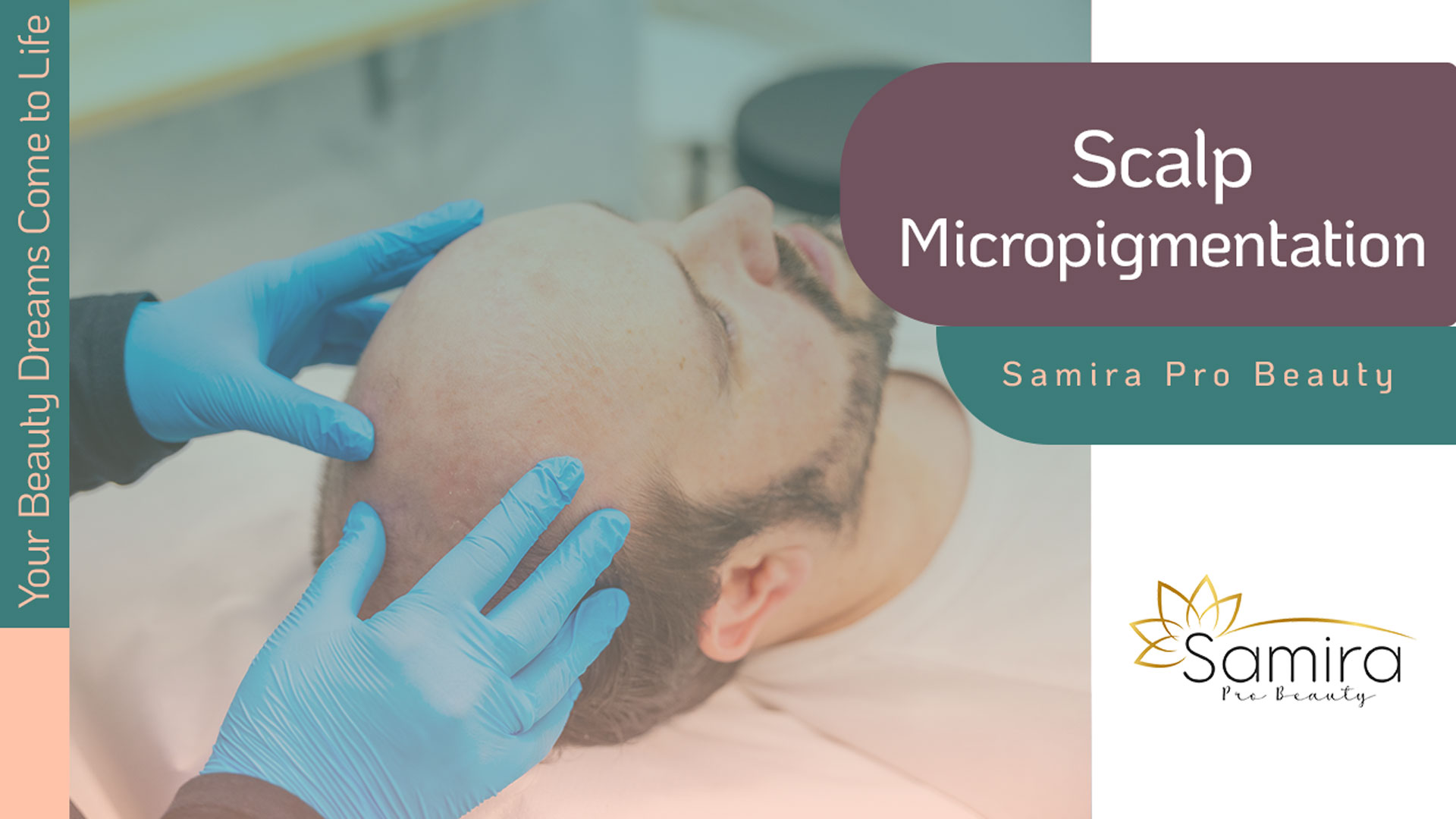 Scalp Micro-Pigmentation Vancouver